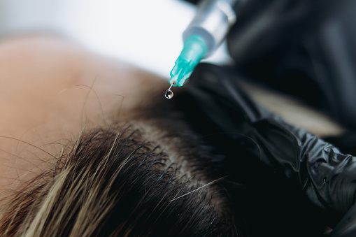 centre-cloe-esthetique-calais (4).jpg