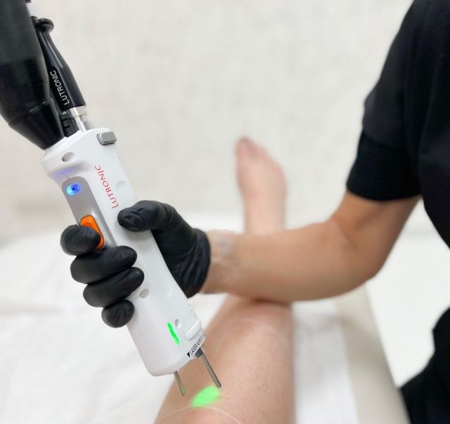 Epilation Laser Calais